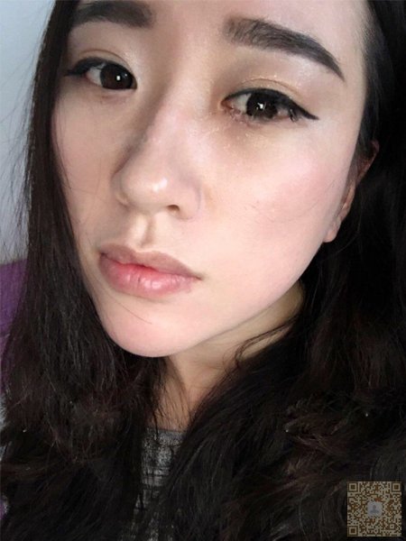 超 声 波去眼袋帮wǒ去掉眼袋le 超 声 波去眼袋帮wǒ去掉眼袋le