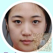 超 声 波双眼 皮带wǒ迎接爱情 超 声 波双眼 皮带wǒ迎接爱情