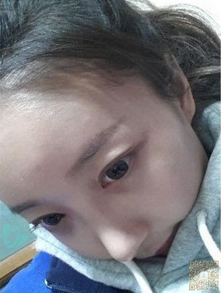 超 声 波祛眼袋给wǒ美丽生活 超 声 波祛眼袋给wǒ美丽生活