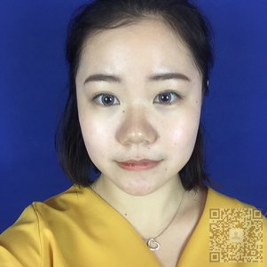 超雅不开刀隆鼻手术做得安全又好看912 超雅不开刀隆鼻手术做得安全又好看912