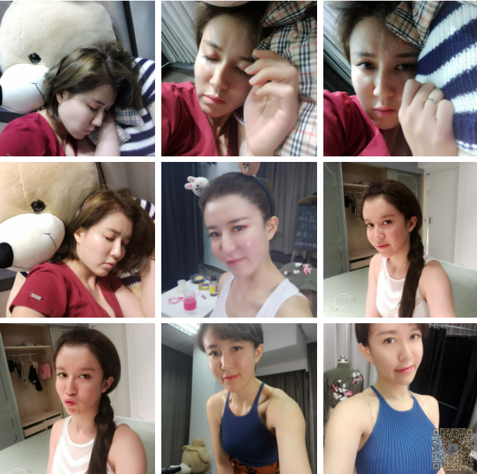 超声波丰胸让你的胸部手感非常自然301 超声波丰胸让你的胸部手感非常自然301
