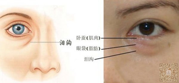 恢复靓丽双眸就选超声波祛眼袋273 恢复靓丽双眸就选超声波祛眼袋273