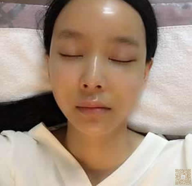 和朋友一起做了超声波祛眼袋,一起变漂亮576 和朋友一起做了超声波祛眼袋,一起变漂亮576