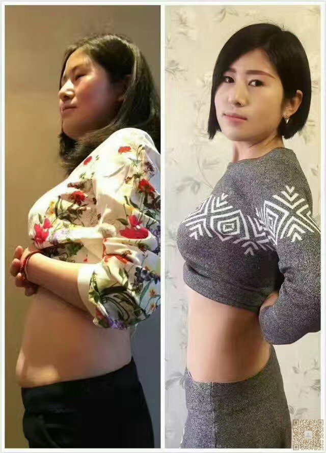 超 声 波减肥使wǒ终于减肥成功啦啦 超 声 波减肥使wǒ终于减肥成功啦啦