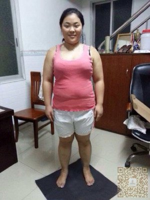 风靡朋友圈的减肥达人分享：我做了超声波减肥成功瘦身216