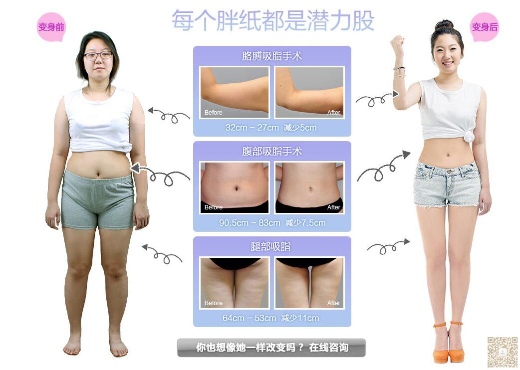 超声波减肥适合懒惰想减肥的女生638 超声波减肥适合懒惰想减肥的女生638