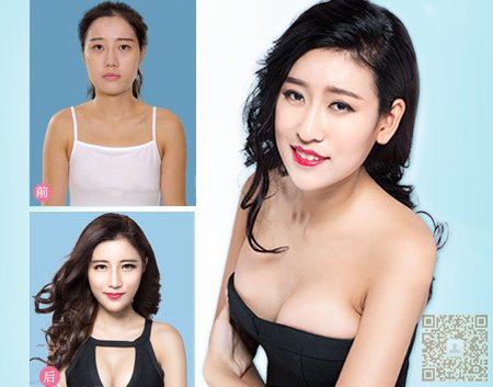 做了超声波丰胸之后终于出了口气180 做了超声波丰胸之后终于出了口气180