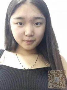 姐妹们我做了超声波双眼皮,看看怎么样啊379 姐妹们我做了超声波双眼皮,看看怎么样啊379