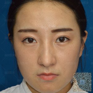 超雅超声波面部提升给我好气质201 超雅超声波面部提升给我好气质201