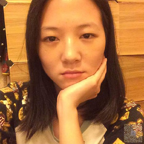 超 声 波祛眼袋,让眼袋彻底say拜拜 超 声 波祛眼袋,让眼袋彻底say拜拜