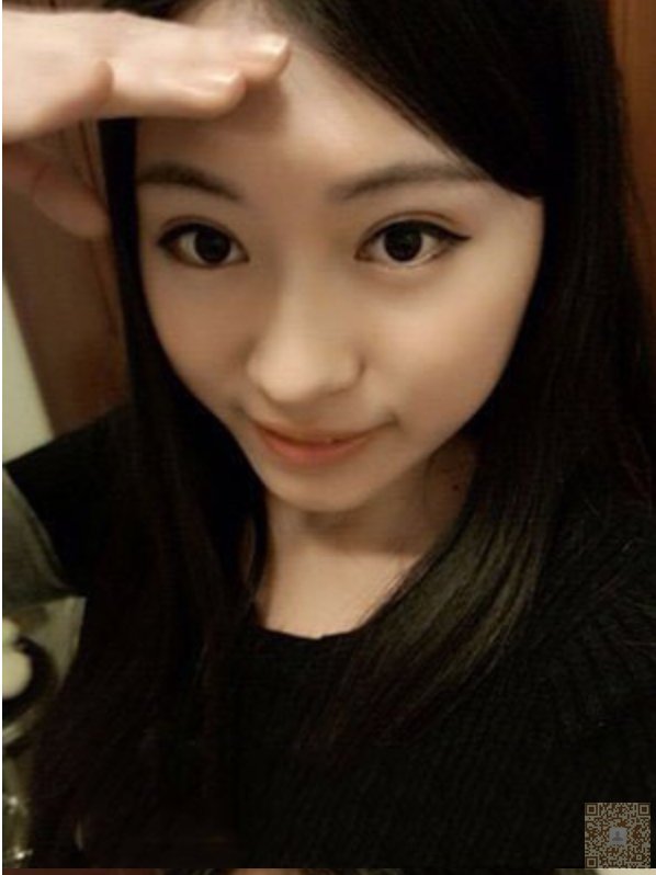 超声波双眼皮让你没有抬头纹592 超声波双眼皮让你没有抬头纹592