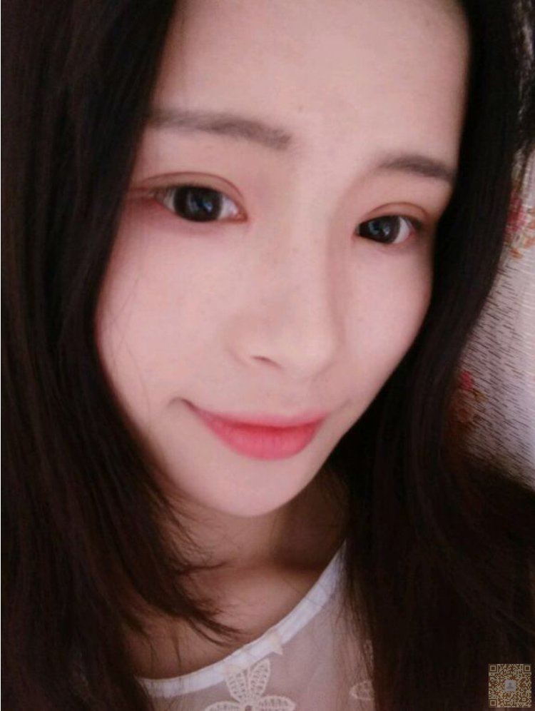 超声波双眼皮让你没有抬头纹592 超声波双眼皮让你没有抬头纹592