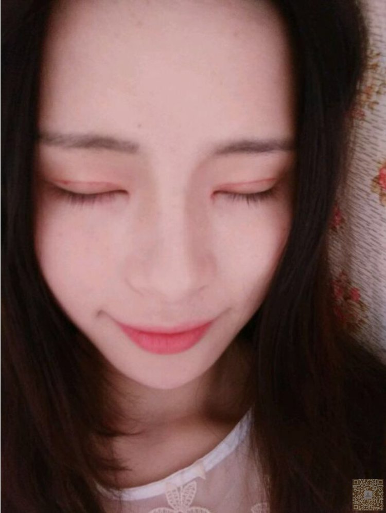 超声波双眼皮让你没有抬头纹592 超声波双眼皮让你没有抬头纹592