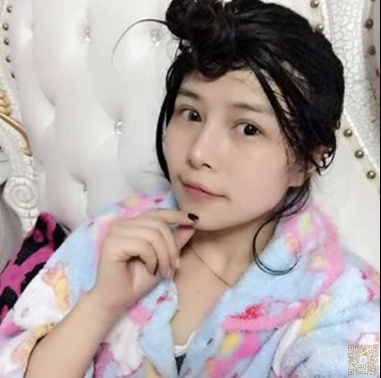 超 声 波去眼袋帮wǒ去掉眼袋