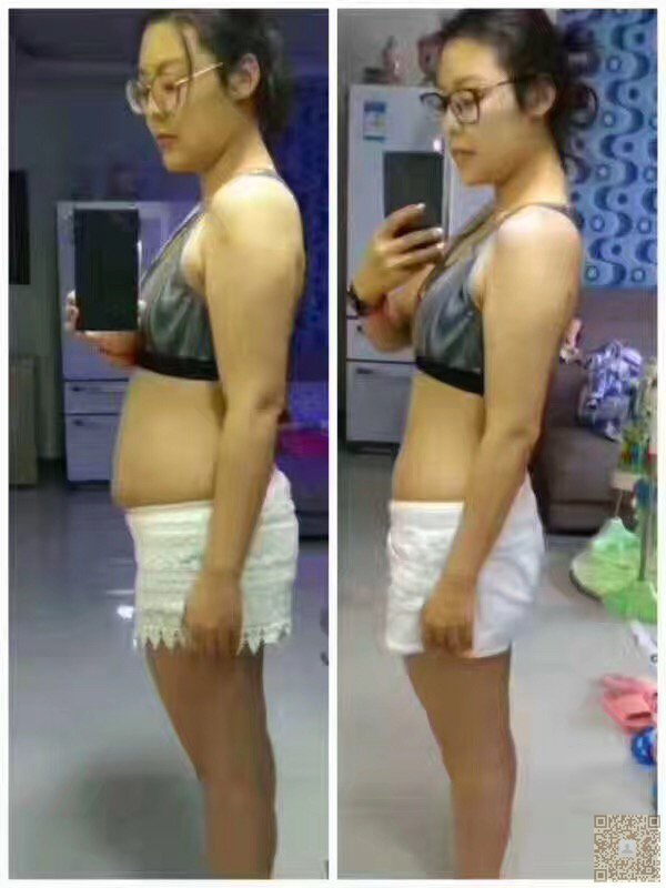 超声波减肥,让我脱离了胖子643 超声波减肥,让我脱离了胖子643