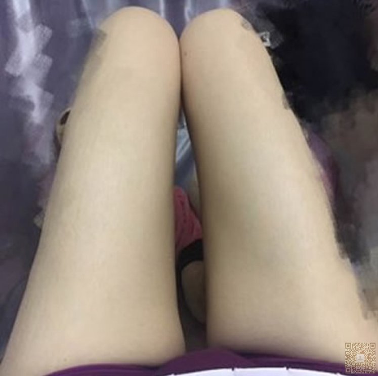 wǒ做得超 声 波减肥超级成功 wǒ做得超 声 波减肥超级成功