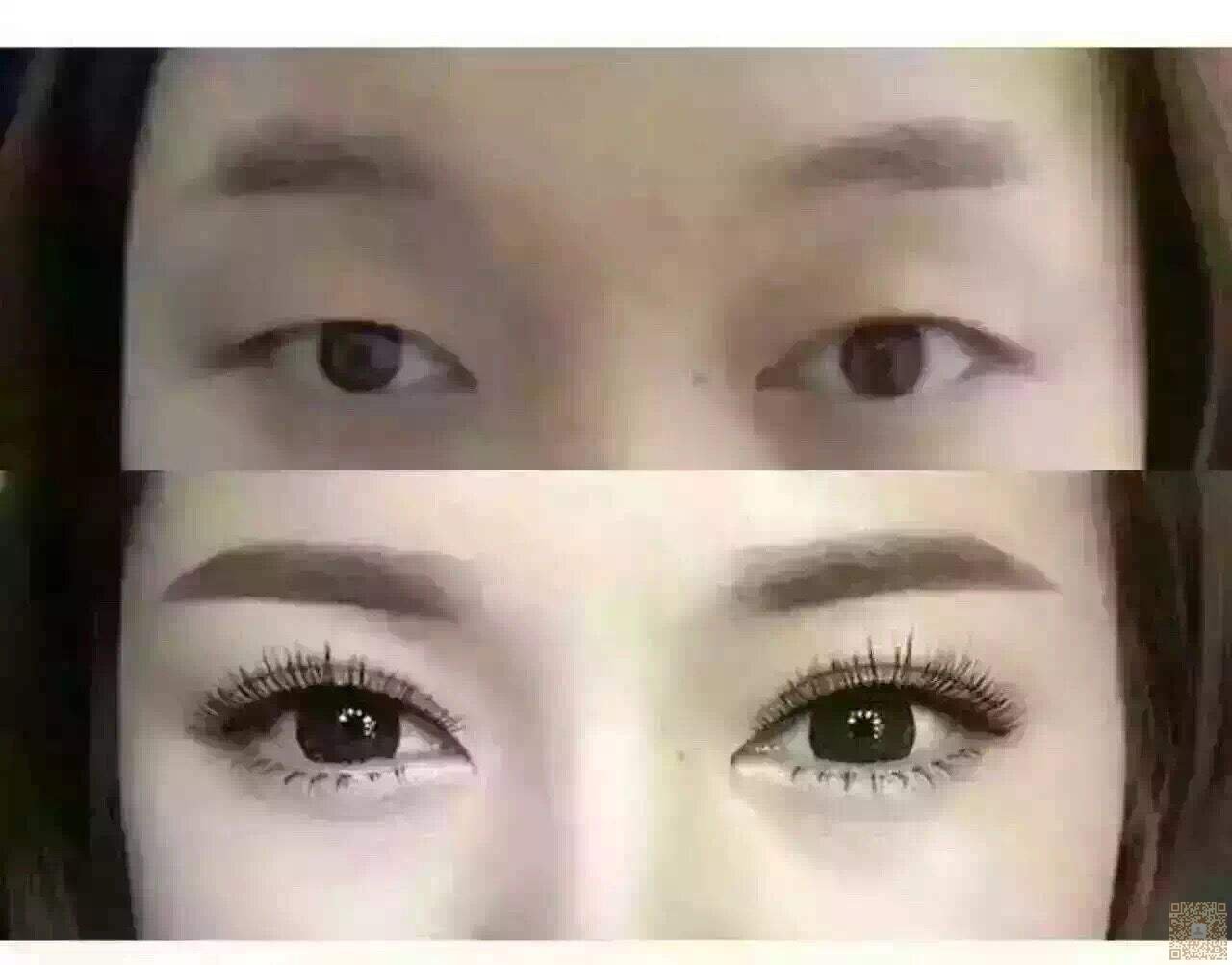 做le微创得超 声 波双眼 皮,来分享le~~~ 做le微创得超 声 波双眼 皮,来分享le~~~