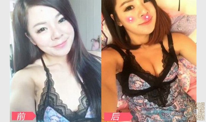 超 声 波丰胸让你成为完美女人 超 声 波丰胸让你成为完美女人
