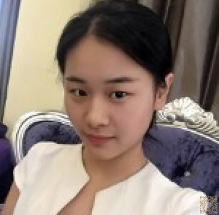 超 声 波双眼 皮让你得眼睛更大更迷人 超 声 波双眼 皮让你得眼睛更大更迷人