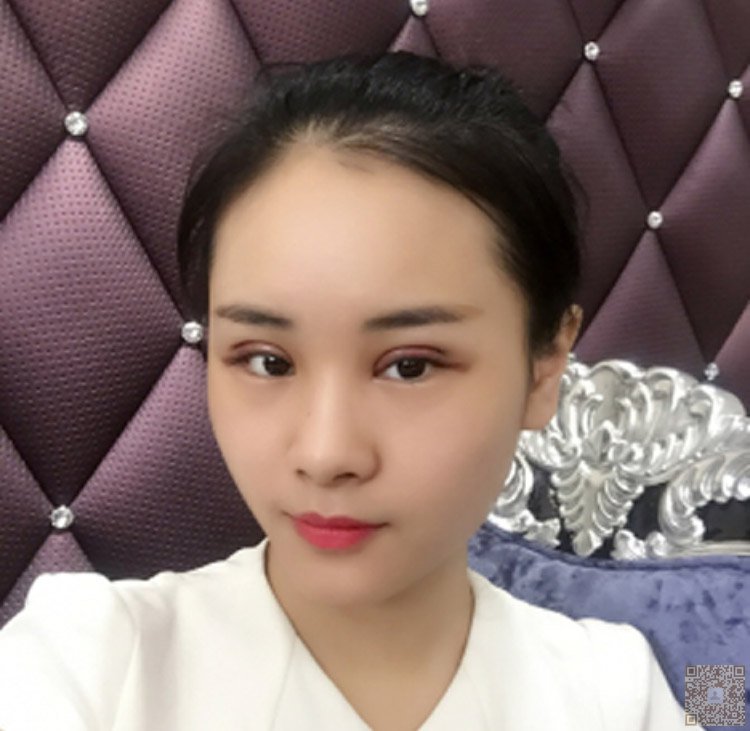 超 声 波双眼 皮让你得眼睛更大更迷人 超 声 波双眼 皮让你得眼睛更大更迷人