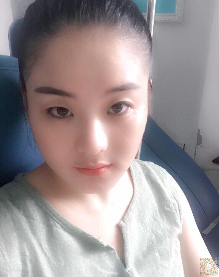 超 声 波双眼 皮让你成为双眼 皮女生 超 声 波双眼 皮让你成为双眼 皮女生