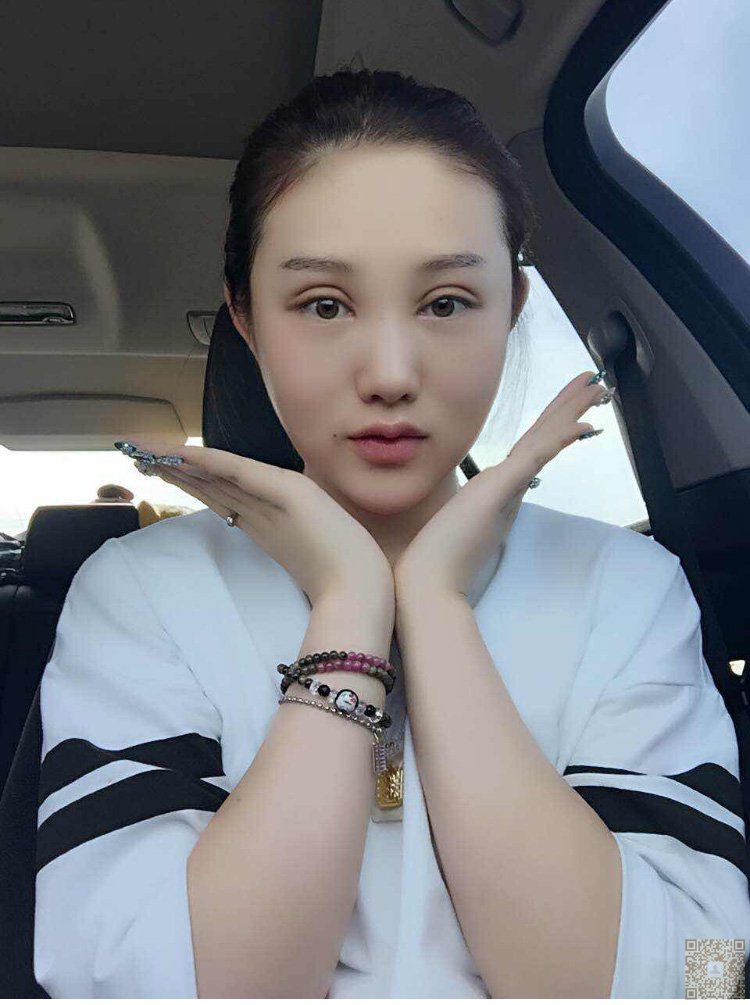 我对重庆超雅的超声波双眼皮超级满意820 我对重庆超雅的超声波双眼皮超级满意820