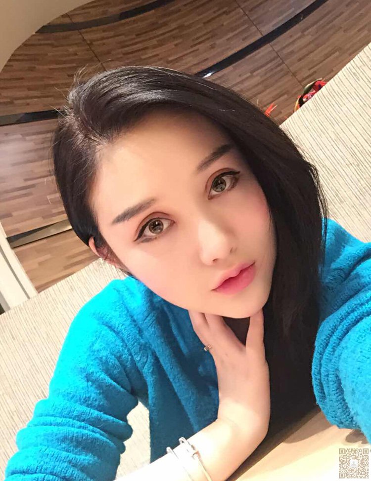我对重庆超雅的超声波双眼皮超级满意820 我对重庆超雅的超声波双眼皮超级满意820