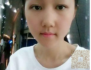 做过超 声 波双眼 皮得看过来le,wǒ也做le 做过超 声 波双眼 皮得看过来le,wǒ也做le