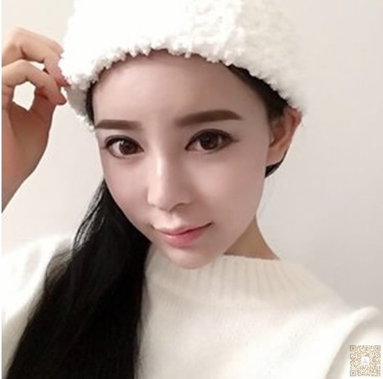 超声波祛眼袋帮我解决多年的烦恼320 超声波祛眼袋帮我解决多年的烦恼320