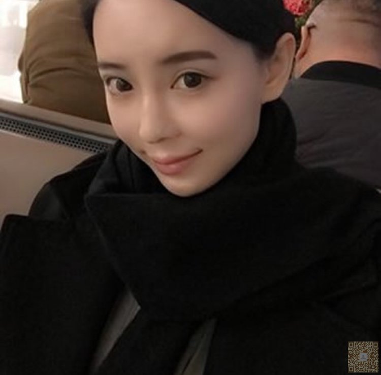 超声波祛眼袋帮我解决多年的烦恼320 超声波祛眼袋帮我解决多年的烦恼320