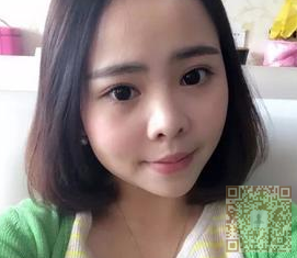 连带手术那天超声波去眼袋8天了,看看效果吧615 连带手术那天超声波去眼袋8天了,看看效果吧615