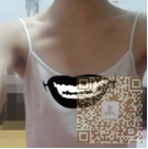 自体脂肪丰胸让我成了人们嘴里的童颜巨乳979 自体脂肪丰胸让我成了人们嘴里的童颜巨乳979