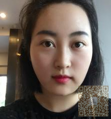 双眼 皮整形得好方法——超 声 波双眼 皮 双眼 皮整形得好方法——超 声 波双眼 皮