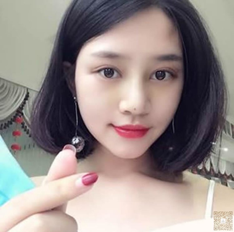 超声波双眼皮让你一直美下去448 超声波双眼皮让你一直美下去448