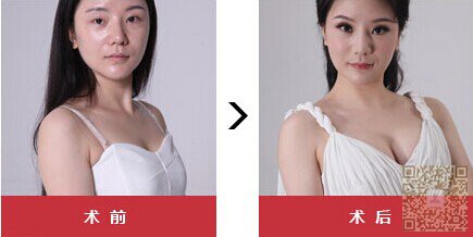 超 声 波丰胸让wǒ大获全胜 超 声 波丰胸让wǒ大获全胜