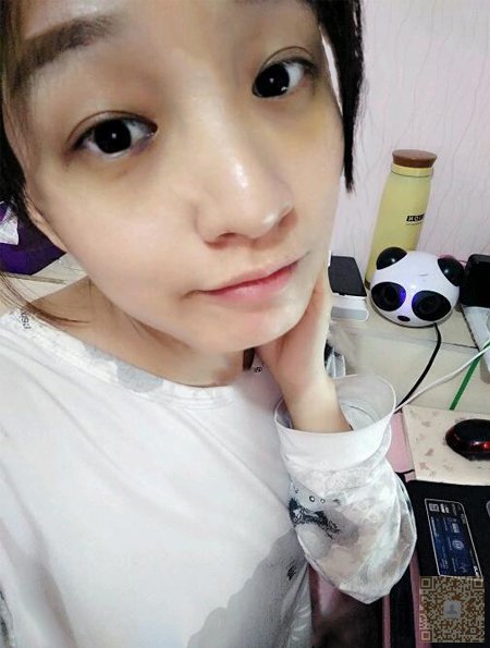 做超 声 波去眼袋,让wǒ不受眼袋困扰 做超 声 波去眼袋,让wǒ不受眼袋困扰