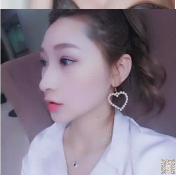 超声波瘦脸让我脸蛋小了856