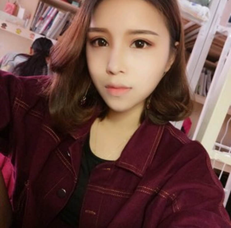 汉子也是可以做超声波双眼皮,让眼睛变得有神214 汉子也是可以做超声波双眼皮,让眼睛变得有神214