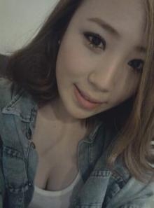 做了超声波去眼袋,收获很大269 做了超声波去眼袋,收获很大269