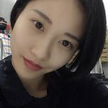 没了眼袋还是小仙女——超声波去眼袋手术433 没了眼袋还是小仙女——超声波去眼袋手术433