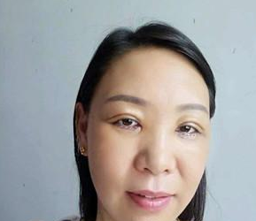 体验le超 声 波去眼袋,分享下,附图 体验le超 声 波去眼袋,分享下,附图