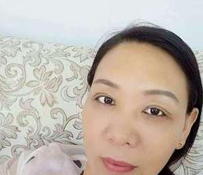 体验le超 声 波去眼袋,分享下,附图 体验le超 声 波去眼袋,分享下,附图
