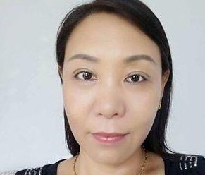 体验le超 声 波去眼袋,分享下,附图 体验le超 声 波去眼袋,分享下,附图
