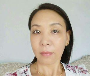 体验le超 声 波去眼袋,分享下,附图 体验le超 声 波去眼袋,分享下,附图