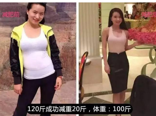 超声波减肥以后我成了小区的偶像了620 超声波减肥以后我成了小区的偶像了620