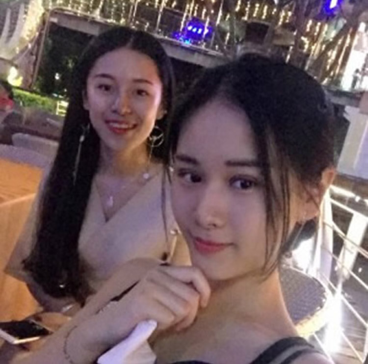 超 声 波双眼 皮手术让wǒ拥有魅力大眼 超 声 波双眼 皮手术让wǒ拥有魅力大眼