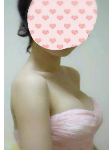 超声波丰胸技术让我成为真正女人736 超声波丰胸技术让我成为真正女人736
