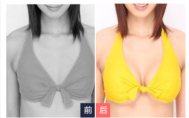 超声波丰胸让你的模特的梦想更进一步282 超声波丰胸让你的模特的梦想更进一步282