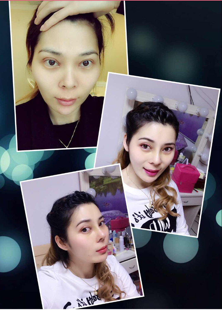 有le超 声 波双眼 皮化妆不再愁 有le超 声 波双眼 皮化妆不再愁