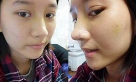 超 声 波双眼 皮让wǒ跟男朋友重归于好